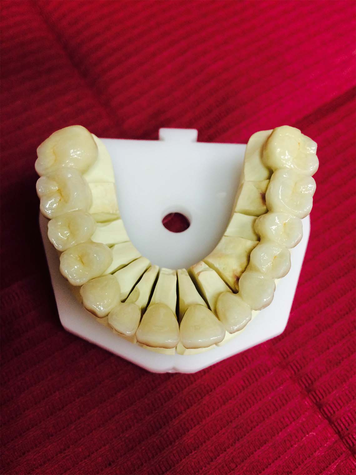 Proteza zębowa