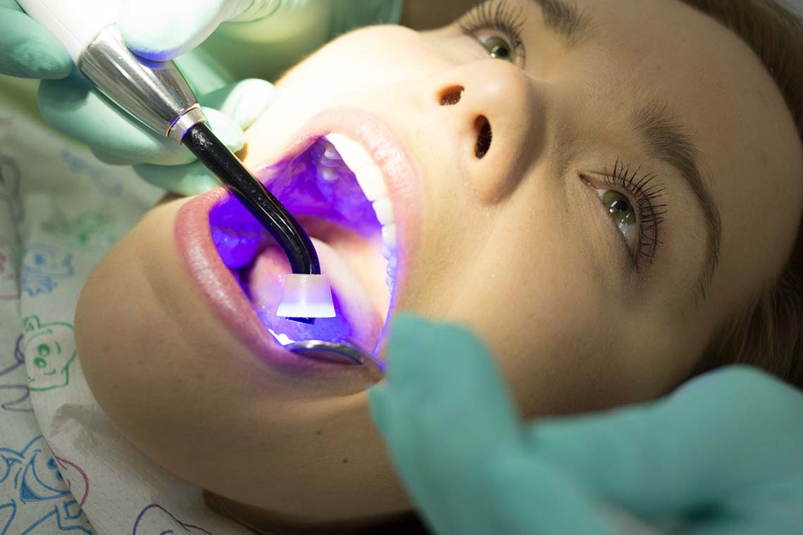 Wykorzystanie fluorescencji w stomatologii zachowawczej